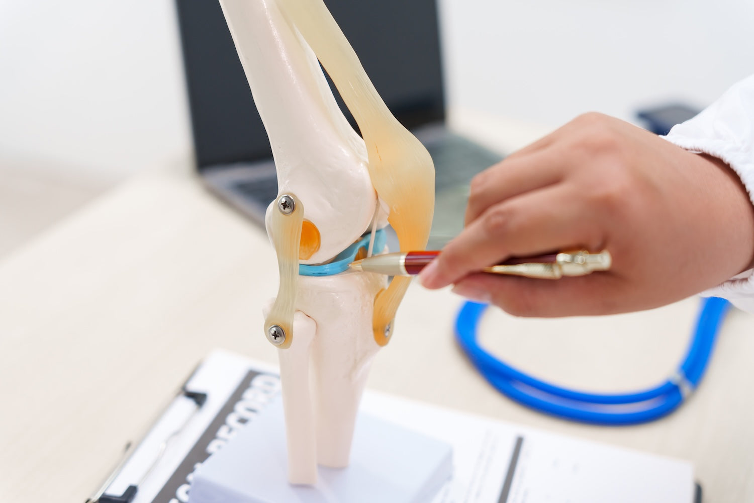 Doctor using a knee joint model to demonstrate joint anatomy — HDAAs for powering recovery and structural integrity of joints